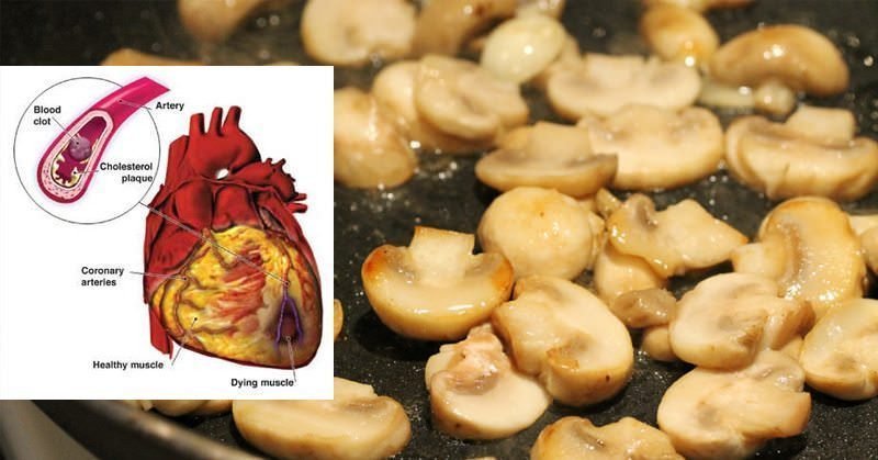 Heal Cardiovascular Disease With The Medicinal Power Of Mushrooms